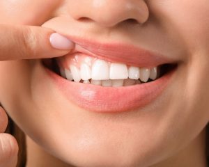 woman showing her smile