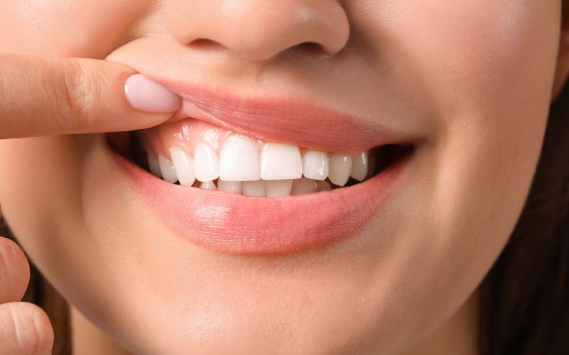 woman showing her healthy gums