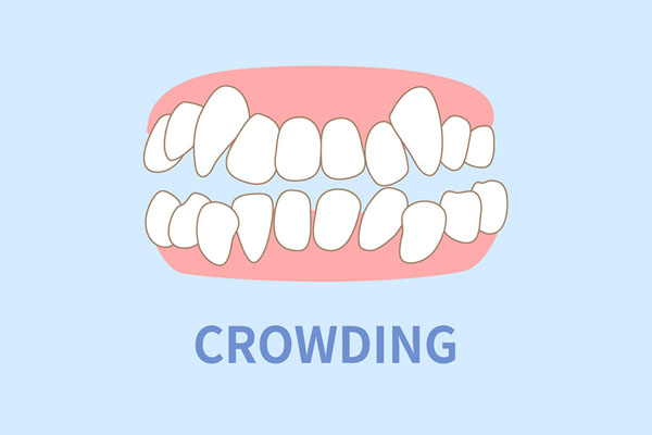 crowding illustration