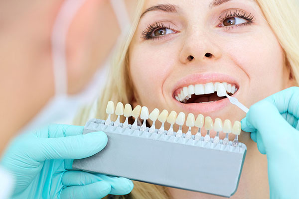 woman getting veneers