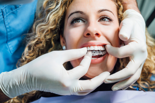 woman getting fitted for clear aligners
